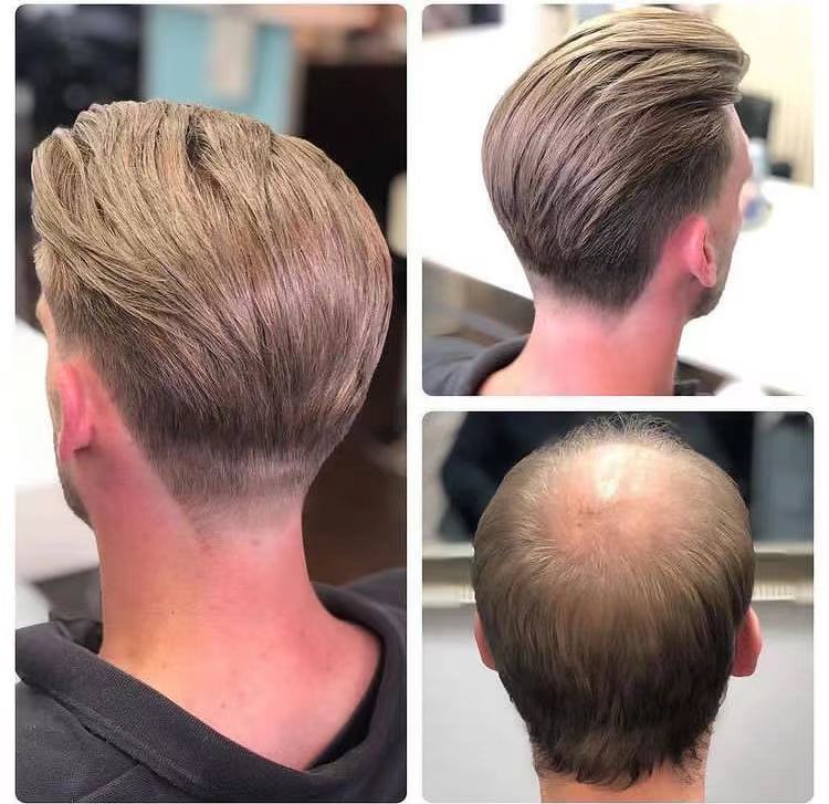 How to customize toupee for men?